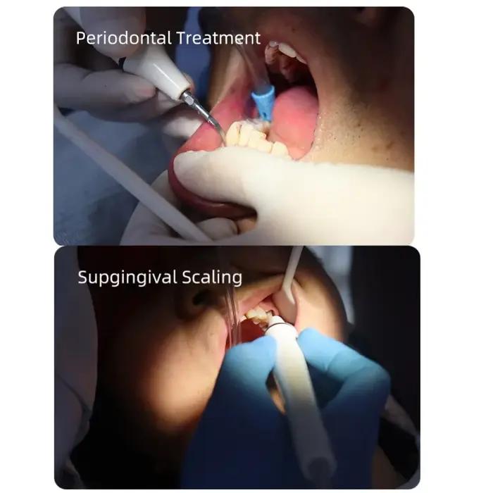 VVDental VET-1 Détartreur Ultrasonique Portable pour l'élimination profonde de la plaque et du tartre, blanchiment dentaire instantané avec pièce à main de précision
