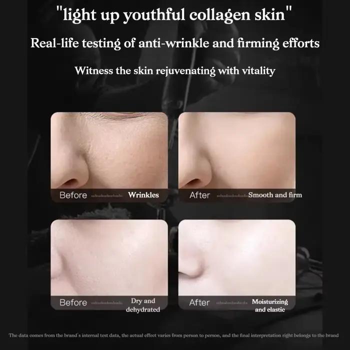 Ampoule éclaircissante à la glutathion 10ml×5 - Sérum hydratant en profondeur pour l'élasticité de l