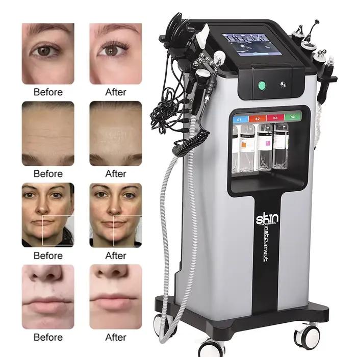 Missheart 10 en 1 eau oxygène Hydro Machine nettoyage en profondeur exfoliant gestion de la peau rég