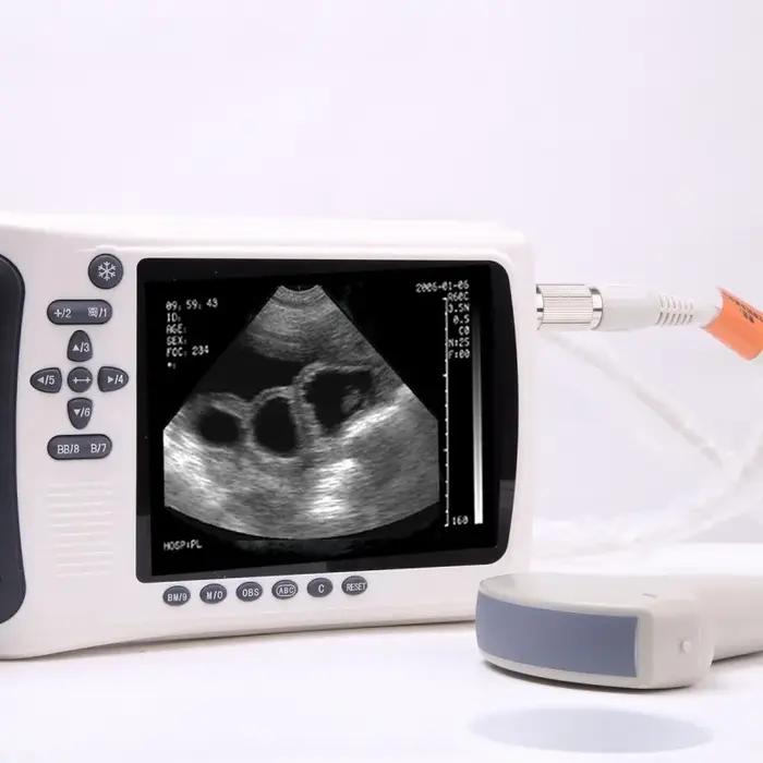 Échographe portable vétérinaire et équipement de diagnostic